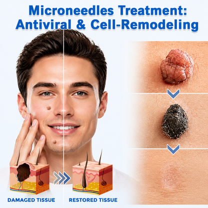 🎖️𝐎𝐟𝐟𝐢𝐜𝐢𝐚𝐥 𝐁𝐫𝐚𝐧𝐝 𝐒𝐭𝐨𝐫𝐞 |2-in-1 Microneedle & Hydrocolloid Patch🍀