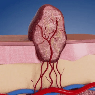 🎖️𝐎𝐟𝐟𝐢𝐜𝐢𝐚𝐥 𝐁𝐫𝐚𝐧𝐝 𝐒𝐭𝐨𝐫𝐞 |2-in-1 Microneedle & Hydrocolloid Patch🍀